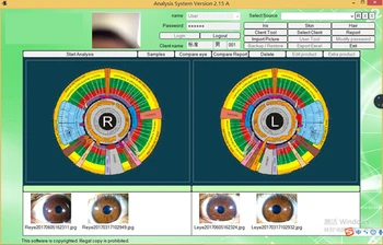 Anglų ispanų, korėjiečių, rusų 12MP sveikatos analizės iris iriscope iridology su auto programinė įranga Nuotrauka 1