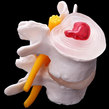 2X Žmogaus Anatomija Skeletas, Stuburas 4-Etapais Juosmeninės Stuburo Modelis Kaukolės Smegenų Traumos Mokymo Reikmenys Nuotrauka 4