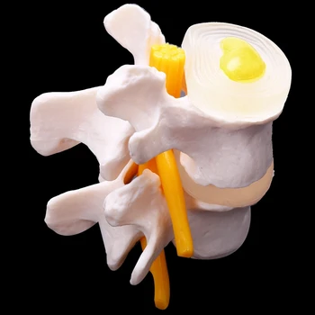 2X Žmogaus Anatomija Skeletas, Stuburas 4-Etapais Juosmeninės Stuburo Modelis Kaukolės Smegenų Traumos Mokymo Reikmenys Nuotrauka 5